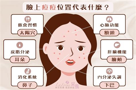 女生長痘痘|青春痘、下巴痘痘長這個位置代表什麼意思？先弄懂長。